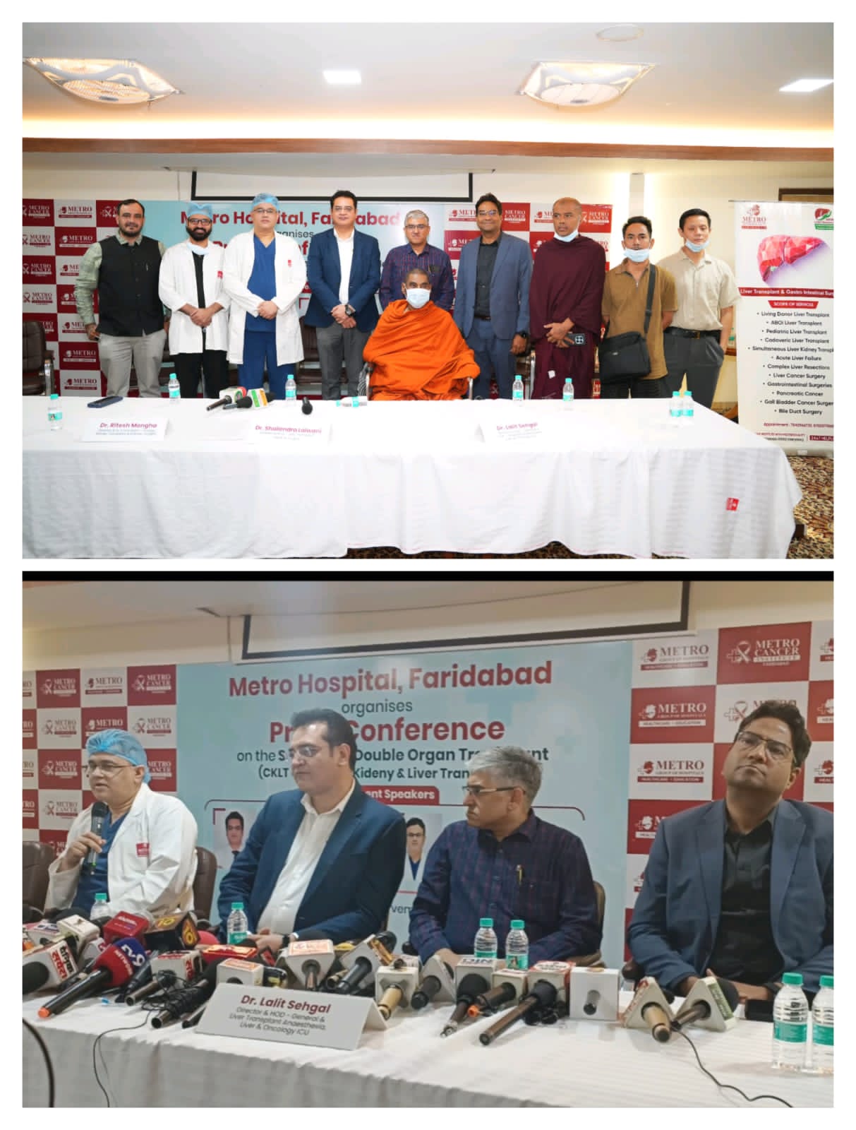 मेट्रो हॉस्पिटल  ने किया विदेशी रोगी का सफल यकृत-गुर्दा संयुक्त प्रत्यारोपड